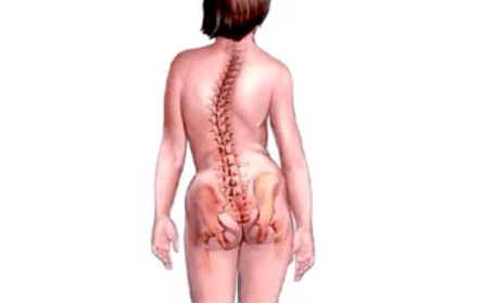 Causes of the development of cervical osteochondrosis
