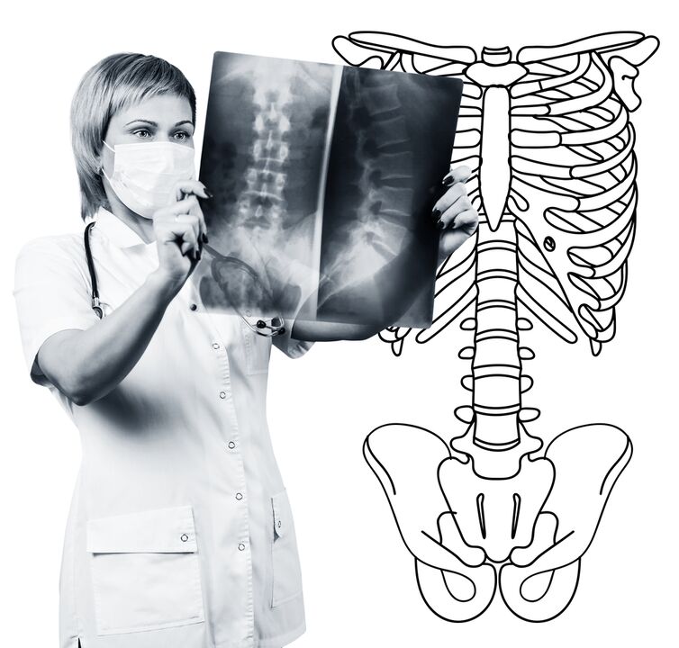 Radiography of the lumbar spine