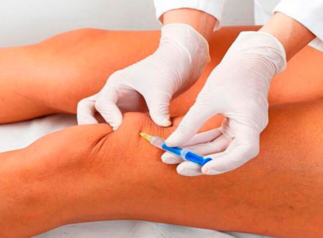 Intra-articular injection of drugs to treat knee joint disease