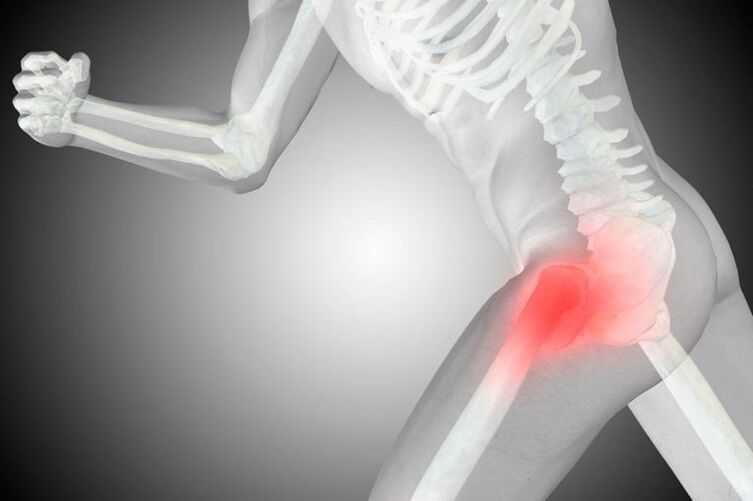 hip joint disease