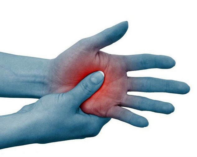 Severe pain in the finger joints is a classic symptom of rheumatoid arthritis and decreases with exercise. 