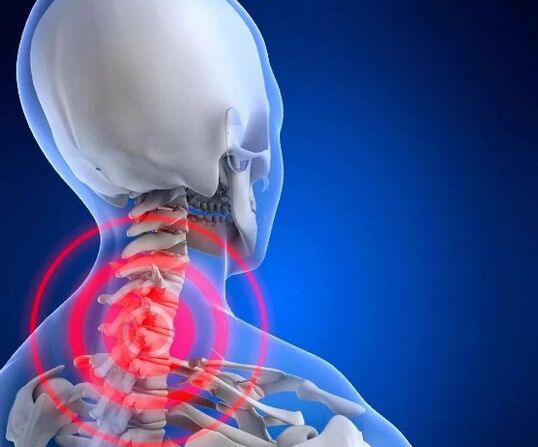 Neck bone and chondropathy
